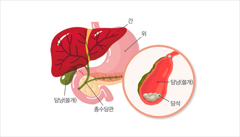 얼굴이 노래지는 이유